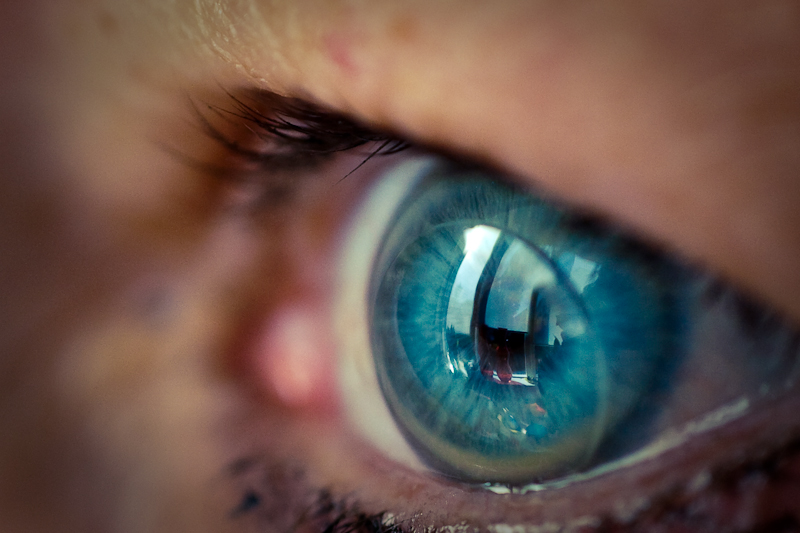 Contact Lens Fitting Toronto Skouras Eye & Cosmetic