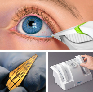 Evolution Of Dry Eye Management