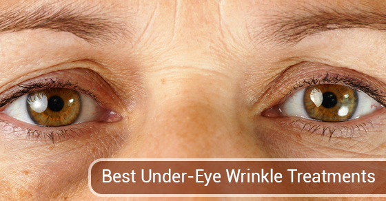  Best Under-Eye Wrinkle Treatments