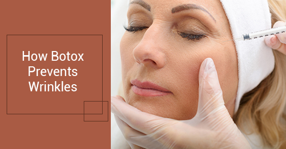  How Botox Prevents Wrinkles